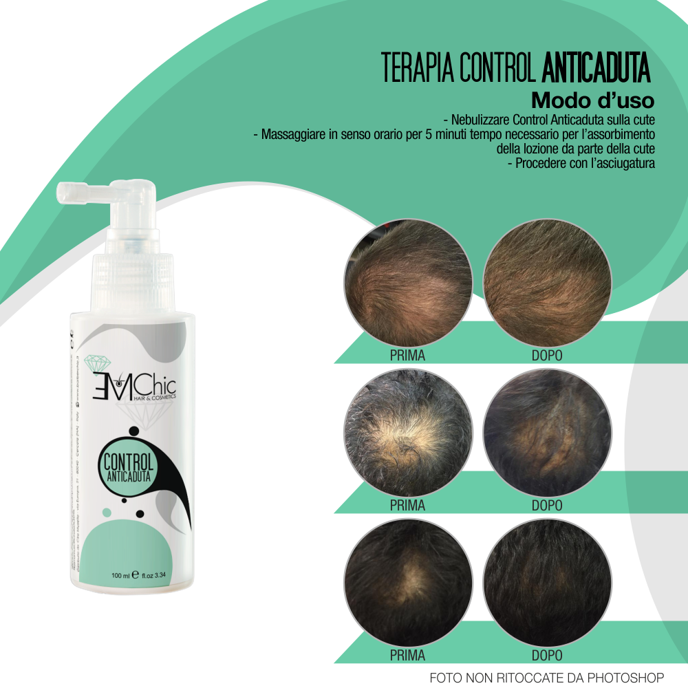 Control Anticaduta