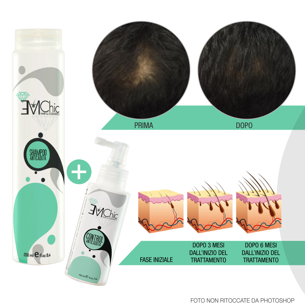Shampoo Anticaduta